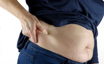 Does Progesterone Cause Weight Gain